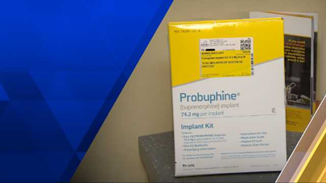 Probuphine Implant